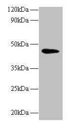Anti-NAPSA Antibody