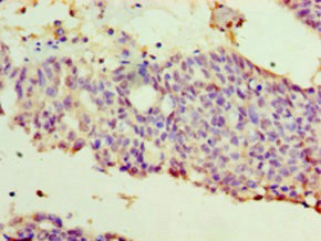 Anti-WT1 Antibody