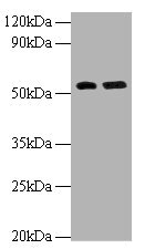 Anti-MMP12 Antibody