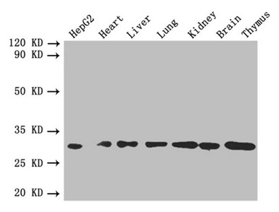Anti-FGF2 Antibody