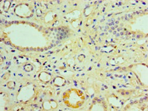 Anti-NR1I3 Antibody