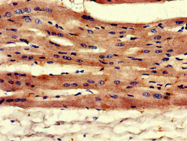 Anti-DES Antibody