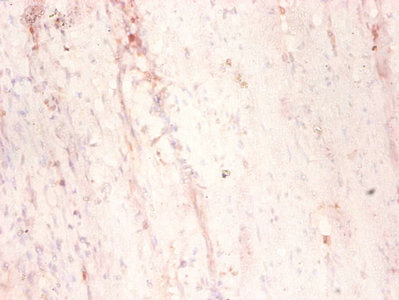Anti-MAP1S Antibody