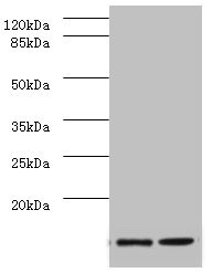 Anti-SAA1 Antibody
