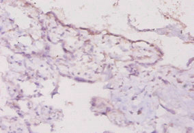 Anti-Ifng Antibody