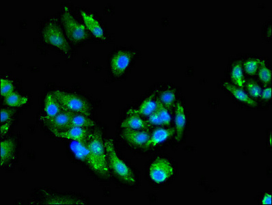 Anti-PRKCZ Antibody