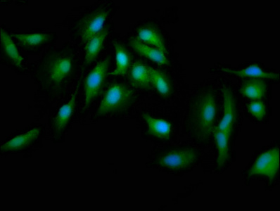 Anti-PRKCD Antibody