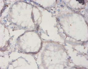 Anti-Il18bp Antibody