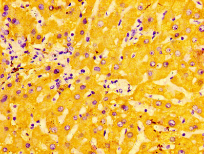 Anti-ASGR1 Antibody