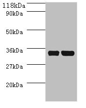 Anti-dcyD Antibody