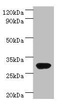 Anti-rbsK Antibody