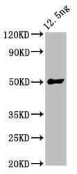 Anti-FTL3 Antibody