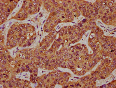 Anti-CD164 Antibody