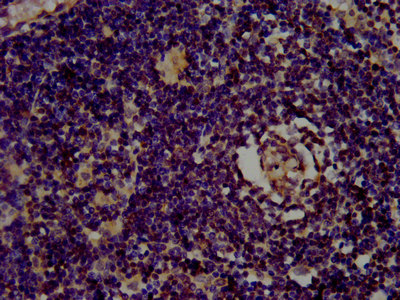 Anti-CLC Antibody