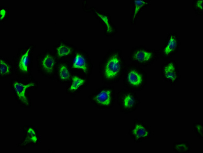 Anti-ATP13A2 Antibody