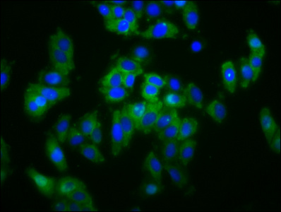 Anti-SLC5A4 Antibody