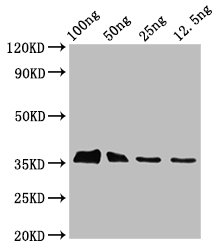 Anti-BLLF3 Antibody
