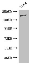 Anti-TSC2 Antibody