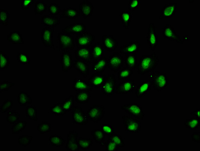 Anti-RAG2 Antibody