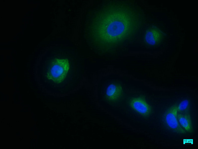 Anti-SHISA9 Antibody