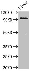 Anti-KDM1A Antibody