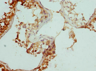 Anti-CCP110 Antibody