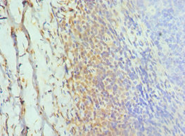 Anti-GOLGA2 Antibody