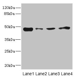 Anti-PDK3 Antibody