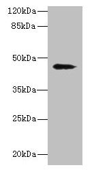 Anti-RBMS2 Antibody