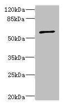 Anti-TBCE Antibody