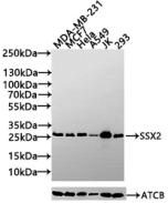 Anti-SSX2 Antibody