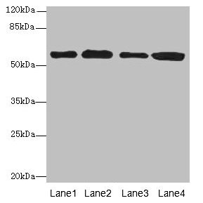 Anti-TXNRD1 Antibody