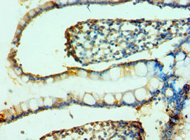 Anti-FAP Antibody