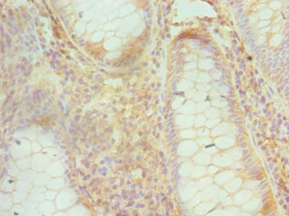 Anti-CUL1 Antibody