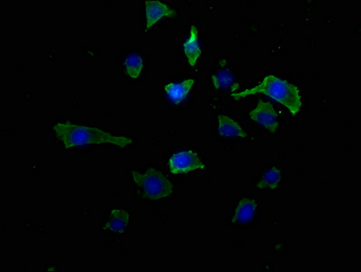 Anti-RAB39A Antibody