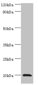 Anti-HSPB2 Antibody