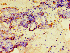 Anti-GPS1 Antibody