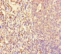 Anti-NFIX Antibody