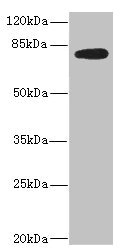 Anti-MEP1B Antibody