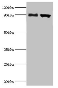 Anti-ADAM9 Antibody