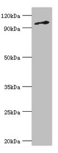 Anti-MCM6 Antibody