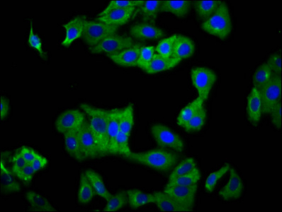 Anti-KIR2DS5 Antibody
