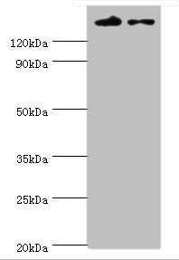 Anti-SETDB1 Antibody