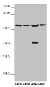 Anti-SLC1A5 Antibody
