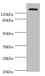 Anti-TP53BP2 Antibody