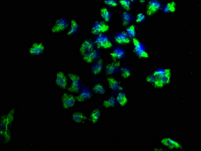 Anti-PRKD1 Antibody