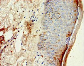 Anti-CST6 Antibody