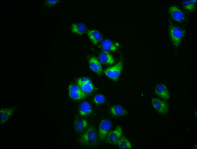 Anti-DRP2 Antibody