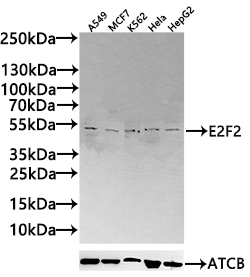 Anti-E2F2 Antibody