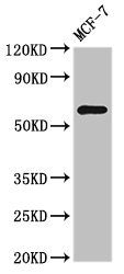 Anti-NR1D2 Antibody